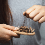 Cabelo Caindo em Excesso?